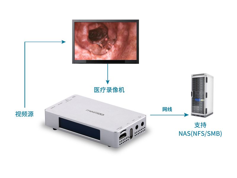 超高清4K醫(yī)療錄像機，輕便型 - 圖片 4